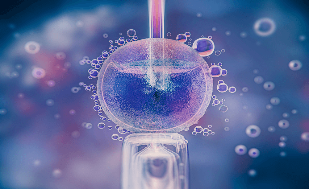 IVF
Advanced reproductive technology helping couples conceive by fertilizing eggs outside the body, offering hope to those with infertility issues.READ MORE