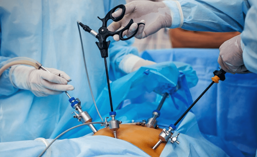 Laparoscopy
Laparoscopy is a minimally invasive surgical technique using small incisions and a camera to diagnose and treat abdominal or pelvic conditions with faster recovery, less pain, and minimal scarring.READ MORE